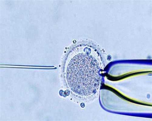 第三代试管婴儿胚胎活检