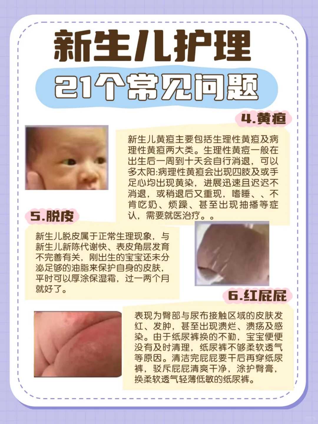 [银川试管婴儿]什么叫做冷冻胚胎？