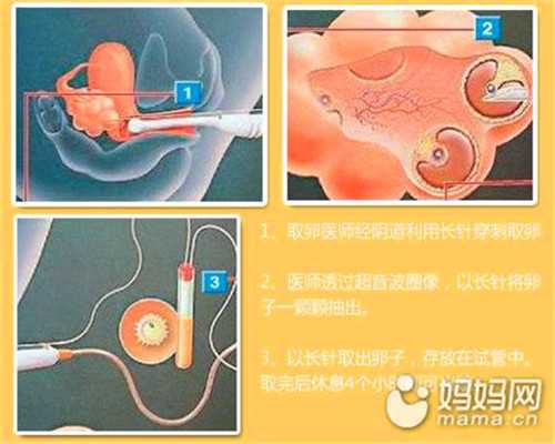 2022最新版天津市试管婴儿医院大全，附成功率前五医院名单分享