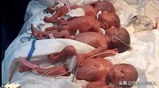 女人想生多胞胎，你知道有多难？马里妇女的九胞胎实在是个奇迹
