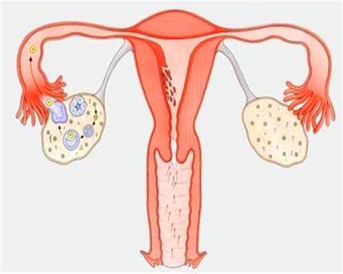 试管人工周期冻胚移植前孕酮多少正常？
