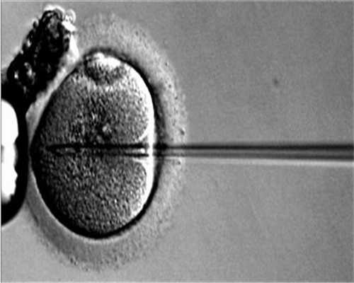 体外胚胎培养收两次费用是因为培育个数太多吗？
